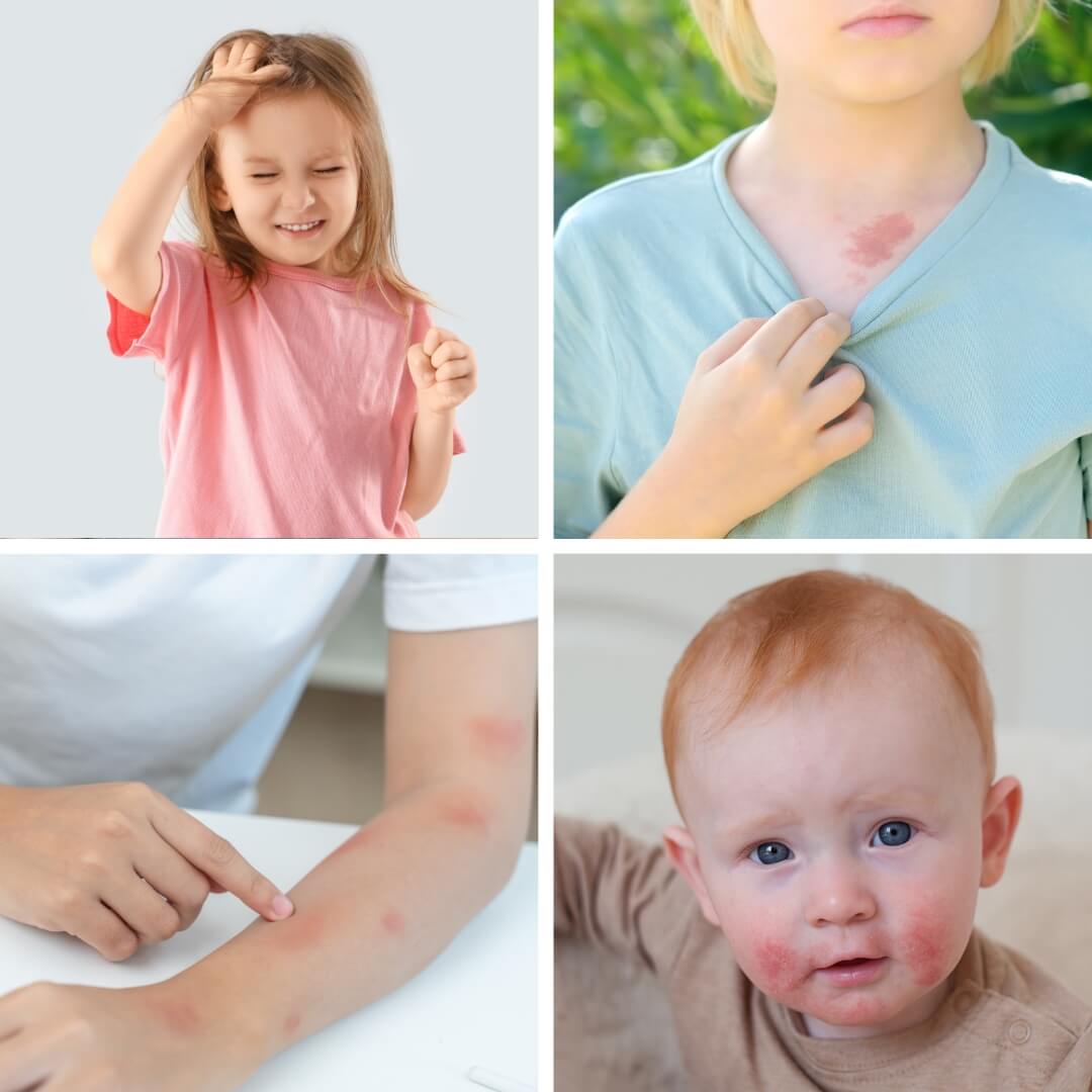 agendar consulta com dermatologista pediátrica em são paulo